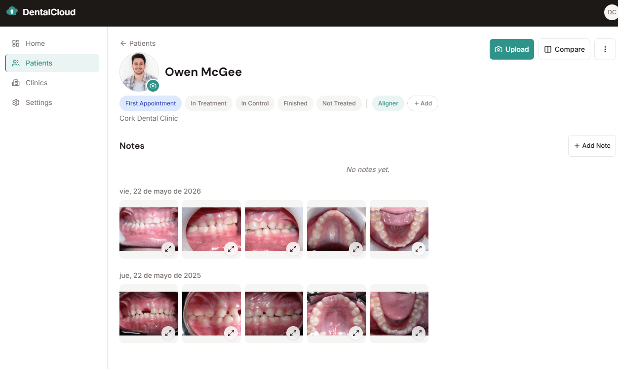 Comparison of patient photos taken at different stages of treatment